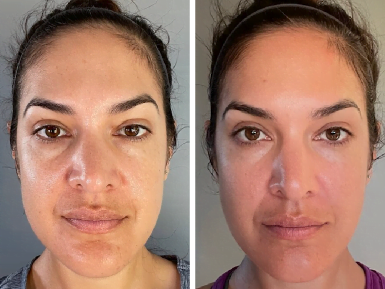 Photo of Before and After