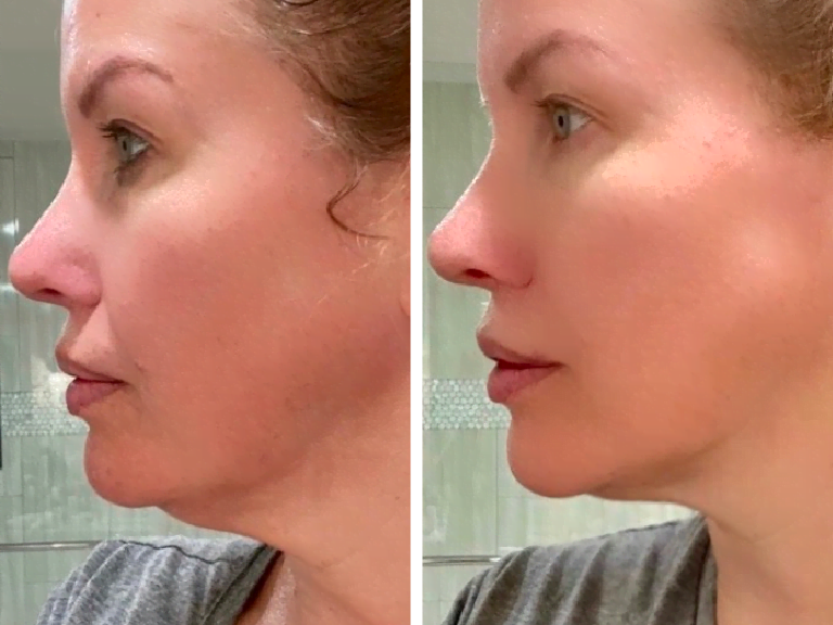 Photo of Before and After