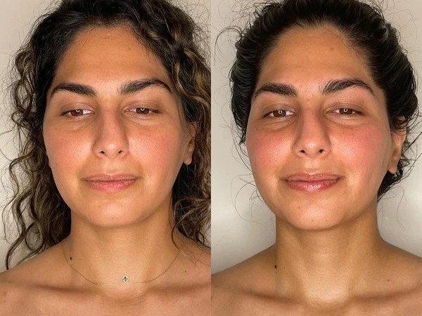 Photo of Before and After