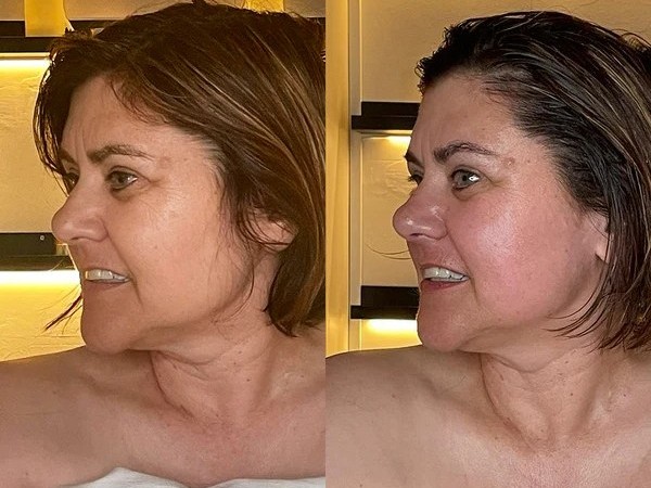 Photo of Before and After